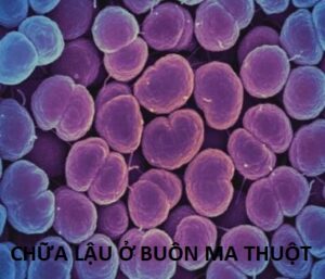 Chữa lậu ở Buôn Ma Thuột
