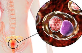 Trị lậu ở Buôn Ma Thuột uy tín