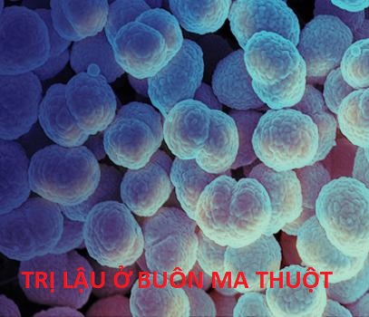 Trị lậu ở Buôn Ma Thuột
