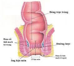 Chữa trĩ Buôn Ma Thuột